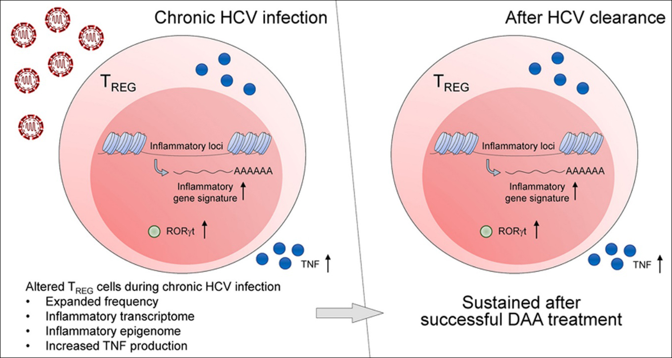 만성C형간염 감염 동안 조절 T 세포(Treg)와 관련된 다양한 염증성 변화가 관찰되며, 이러한 변화는 직접작용 항바이러스제(DAA) 치료 이후에도 지속됨