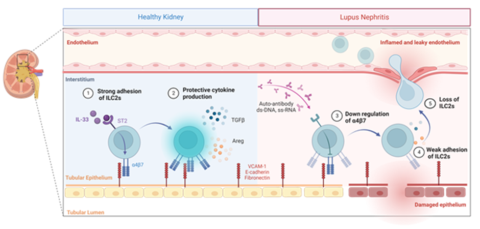 신장내 ILC2의 부착과 이동을 통한 루프스신염 조절기전