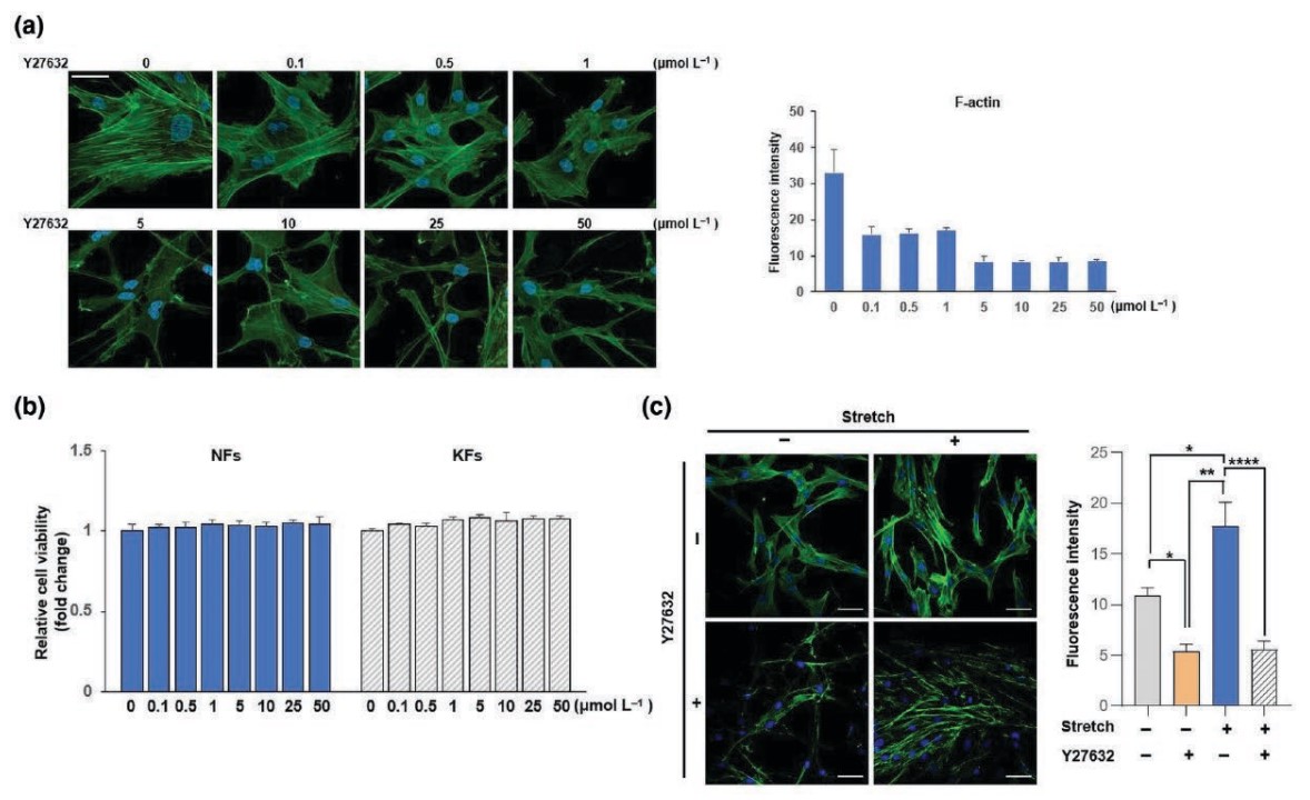 ROCK1 억제제 농도에 따른 섬유아세포 및 filamentous actin (F-actin) 위축효과와 static 및 stretch 상태에서 ROCK 1 억제제의 효과(confocal image)