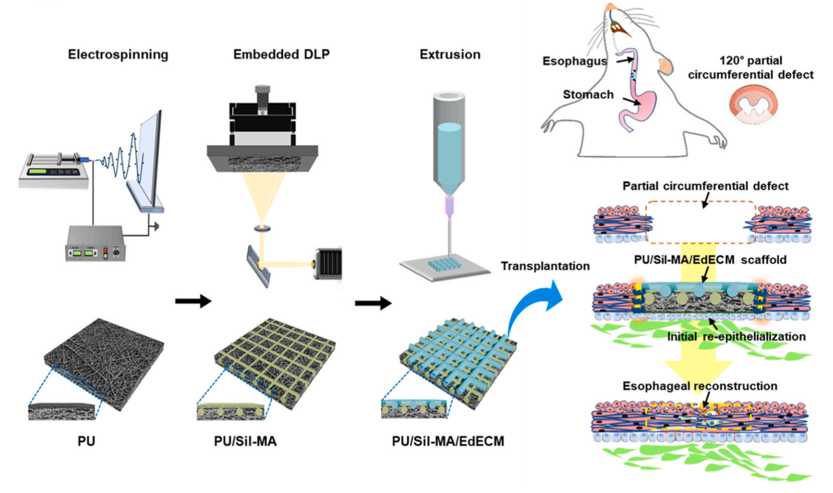 전기방사(electrospinning), 임베디드 DLP(digital light processing), 압출 기반 바이오프린팅 기술을 통합하여 새로운 인공 식도 지지체를 만드는 프로세스. 제작된 복합 지지체를 흰쥐의 식도 결손 부위(120° 부분 결손)에 이식하는 과정을 보여줌. 이식 후 지지체가 주변 조직과 통합되면서 초기 상피화(Re-epithelialization)가 일어나고, 최종적으로 식도의 구조와 기능이 회복되는 단계를 도식화함.